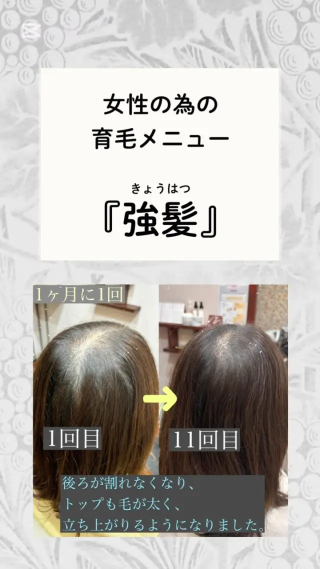 【sheの育毛メニュー‼️】
5年前、10年前と比べて
『髪のボリュームな減った』
『分け目が気になるようになった』
そんなお悩みありませんか？

sheの育毛メニュー『強髪』は
ヒト幹細胞で毛母細胞を活性化させ、
太くて抜けにくい髪を育てます✨　　
　　
1ヶ月に１回で
ほとんどの方が６回目までに変化を感じています☺️ 
　　
美容院の個室で受けられるので、
気軽にご相談頂けます。
先ずはプロフィールのリンクにある
各店舗の予約サイトからご予約下さい。

皆さんカジュアルに育毛メニューされてる時代です☺️🎵

_______________________________

◯sheの育毛メニュー『強髪』◯

sheは女性のお客様お悩み専門美容院です。
その中でも薄毛のお悩みは本当に多く、年齢関係なく20代から悩んでいらっしゃる方も大勢います。
ふんわりして見える髪型やパーマをオススメする事しか出来なかったのが嫌で、
根本解決できる『強髪』を始めました👩‍⚕️

▷sheは
　愛知と静岡に4店舗

全店舗、個室だけの美容院で女性スタイリストがマンツーマンで対応します。
育毛だけでは無いヘアサロンなので他の方の目を気にせず育毛が受けられます。
もちろんカットやカラーも同時に可能🙆‍♀️
カラーのついでに根本的なエイジングケアが受けられます🙆‍♀️

_______________________________

💁‍♀️プロフィールにあるリンクからご予約下さい。

▷愛知県豊橋市東橋良町
▷愛知県豊川市松風町
▷静岡県浜松市大平台　　　
▷静岡県浜松市三方原町　　　の4店舗

30代後半〜70代のお客様がいらっしゃっています。育毛本気で取り組んでいます！
_______________________________

#豊川育毛  #豊橋美容院 #豊橋育毛 ＃強髪
#豊川美容院 #豊橋ヘアサロン #豊橋スタイリスト募集 
#抜け毛予防 #浜松育毛 #美髪 #アンチエイジング  #浜松美容院  #リフトアップ #薄毛