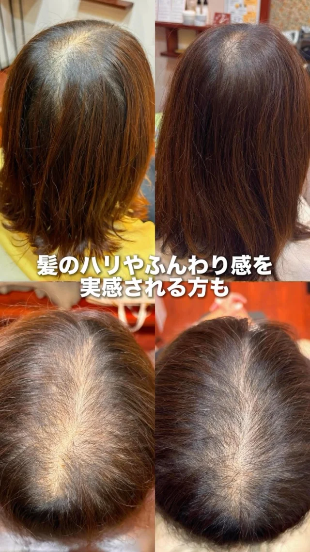 【育毛のための頭皮ケアしてますか？🌱】

わざわざ育毛サロンに行かなくても…
美容院で育毛ケアができちゃいます☺️

美容院で髪の毛にトリートメントする感覚で、
40代からは育毛メニューするのが正解🙆‍♀️

お気軽ご相談下さい🙂‍↕️

▶▶各店舗へのご予約

トップページのリンクから

ご予約ページに繋がっております。

@she.hairsalon

▶豊橋、豊川、浜松市にある大人の女性のヘアサロン✨

通常の美容院とは違う

『女性だけのエイジングケア美容院』

人気の秘密をご紹介します🤫

........................................................

【sheのこだわり】

40代からの、大人女性専門サロン

エイジングケアメニューのみで

スタイリスト歴が長い女性スタッフが、髪の悩みにお答えします！

美容院が苦手な方や、

年齢による髪の悩みにお困りの方😔

全席個室でお悩み解消いたします✨

▶▶各店舗へのご予約

トップページのリンクから

ご予約ページに繋がっております。

@she.hairsalon

▷愛知県豊橋市・東橋良店

▷愛知県・豊川店

▷静岡県浜松市・大平台店

▷静岡県浜松市・三方原店

🆕静岡県浜松市・北寺島店

▶▶求人情報

@shehairsalon_recruit

#豊川育毛 #豊橋美容院 #浜松美容院#浜松育毛 #抜け毛予防